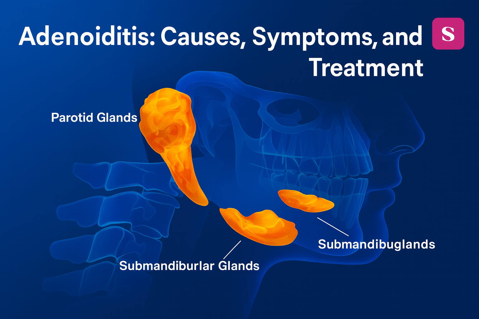 Adenoidid